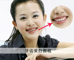 PS人物牙齿美白教程 全福编程网教程